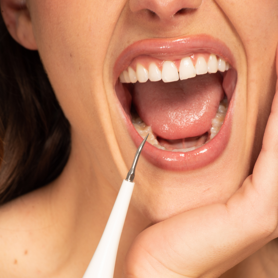 Densine™ - Sonic tooth Cleaner